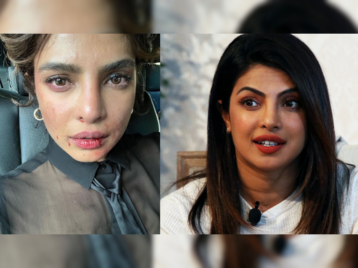 Priyanka Chopra Shared A Weird Photo On Social Media Priyanka Chopra