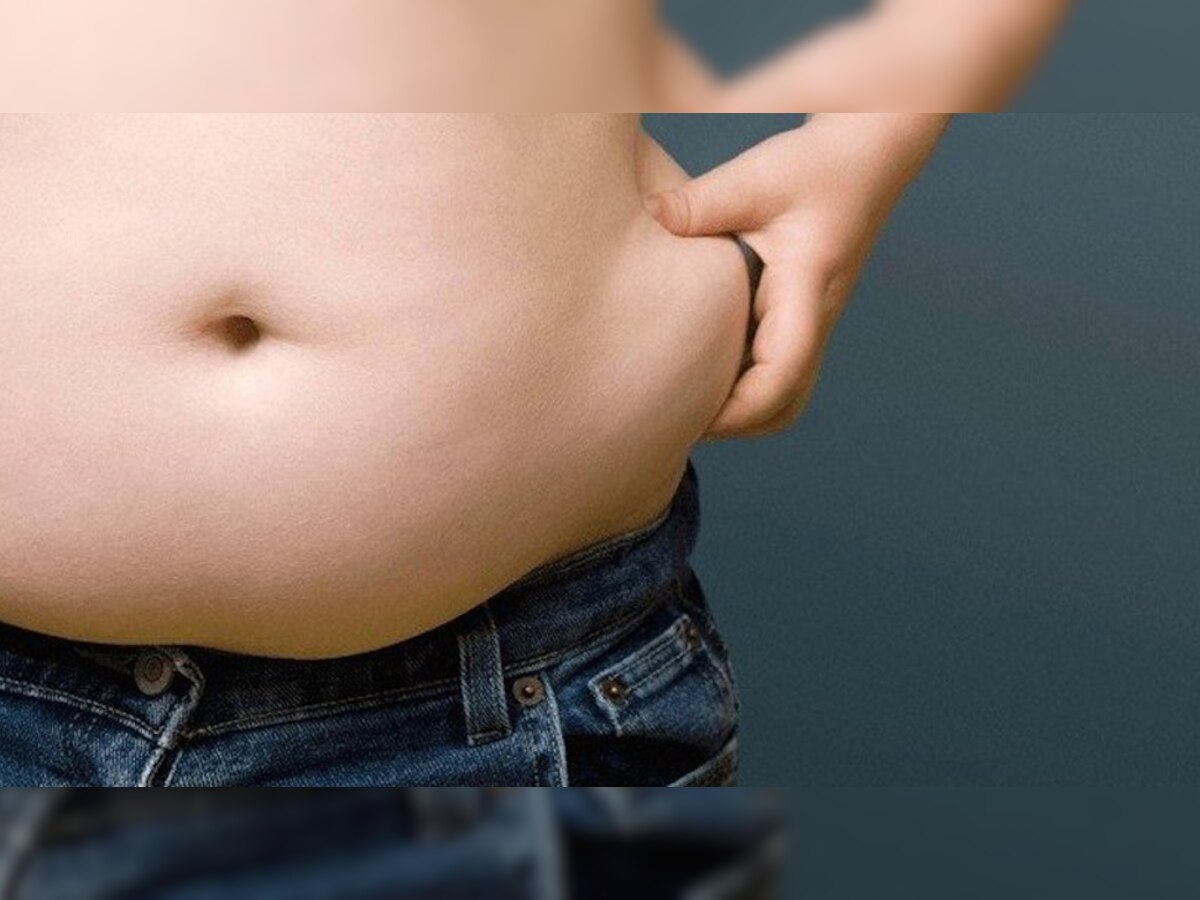Fat removal surgery: फैट घटाने की सर्जरी में जान भी जा सकती है? डॉक्टर ने दिया जवाब, एक्ट्रेस की हुई मौत