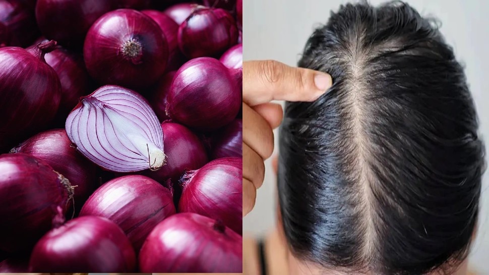Onion Juice for Hair Growth Does it Actually Work  HairMD