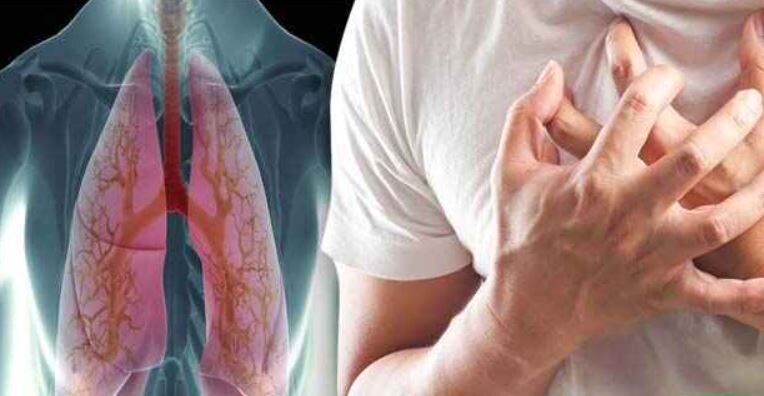 हेल्थ टिप्सः फेफड़ों में जमे बलगम से हो रही है परेशानी? अपनाएं ये 5 तरीके, बीमारियों से मिलेगा आराम