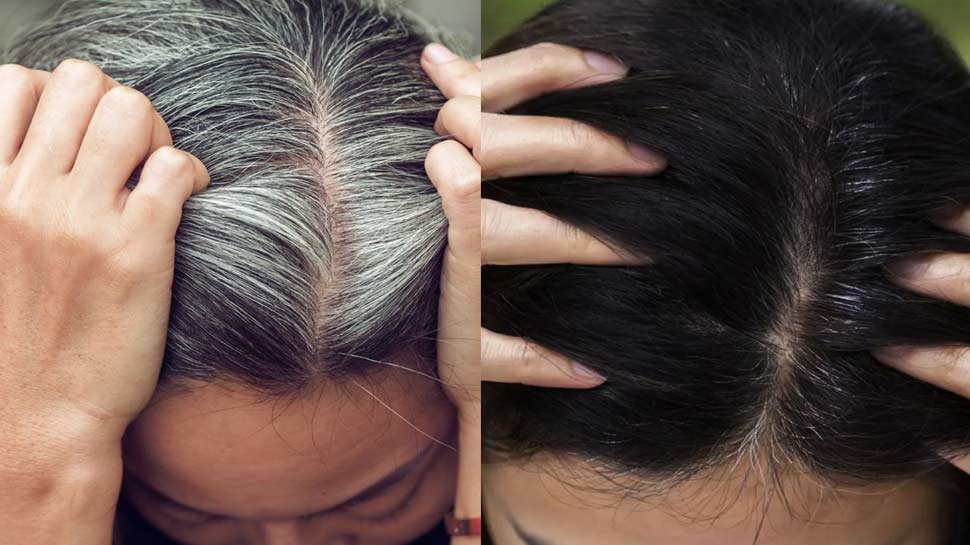Flaxseed For Premature White Hair Home Solution Mask Prepration Apply Dark White Hair वो कौन