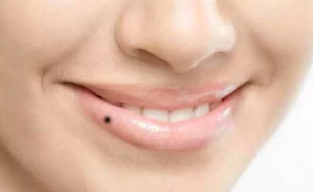 Mole On Lips: आपके होंठ पर भी है तिल, जानिए इसका क्या है मतलब