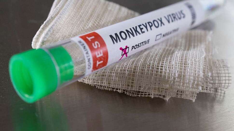 Monkeypox Case in World की ताज़ा खबरे हिन्दी में | ब्रेकिंग और लेटेस्ट ...