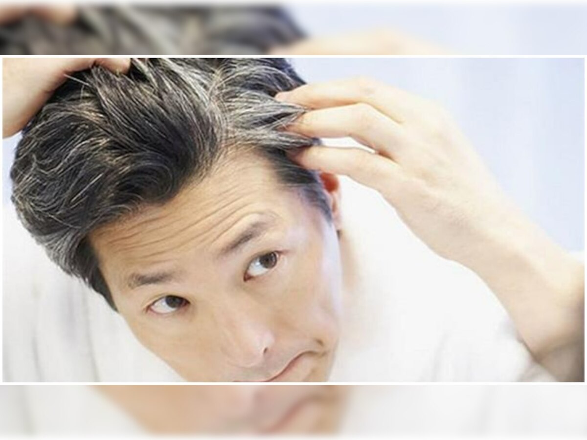 Hair Care Tips: सफेद बालों की समस्या से हैं परेशान? तो ये तरीके करेंगे आपकी मदद