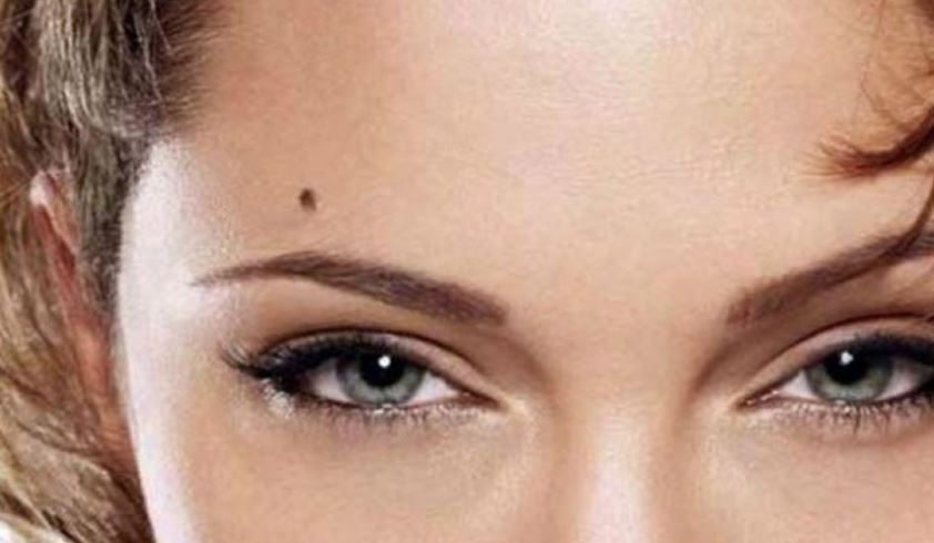 Mole on Forehead: माथे पर तिल बताता है कैसी होगी आपकी किस्मत, इसमें छिपा है खास संदेश