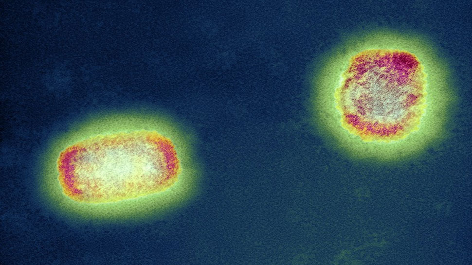 Monkeypox Virus Alert: कोरोना के बाद ये खतरनाक वायरस मचा रहा तबाही! ICMR ने जारी किया अलर्ट