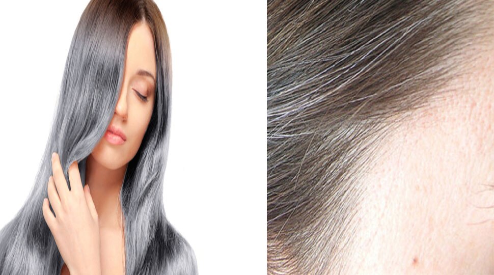 White Hair Treatment best treatment for get black hairs Vitamin B12  Deficiency  White Hair Treatment कम उमर म बल सफद कय हत ह  कह आपक बड म त नह ह रह
