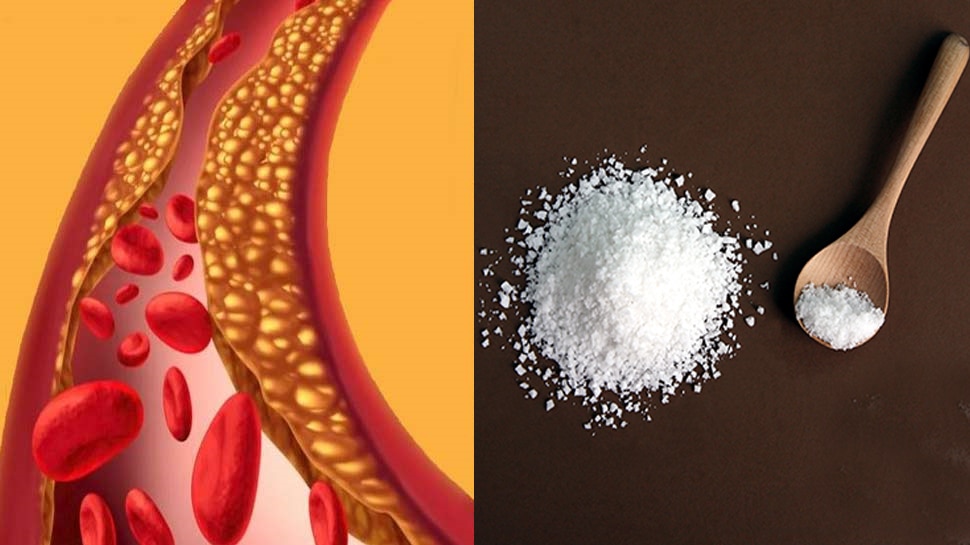 Cholesterol बढ़ने पर सफेद नमक से बना लें दूरी, सॉल्टी टेस्ट बरकरार रखने के लिए खाएं ये चीज