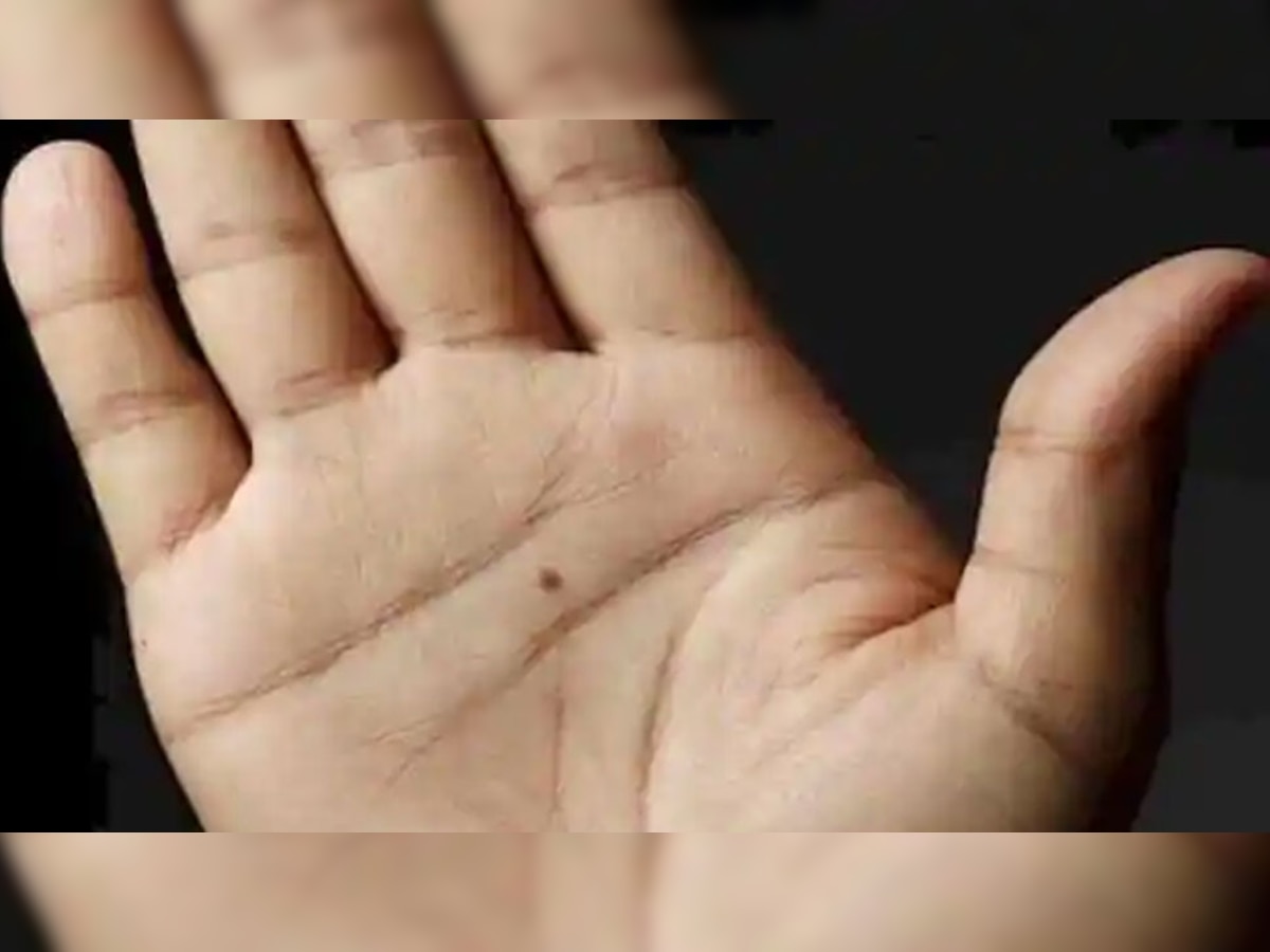Mole On Palm: हाथ के तिल बताते हैं आपकी किस्मत और स्वभाव, जानें क्या कहता है सामुद्रिक शास्त्र