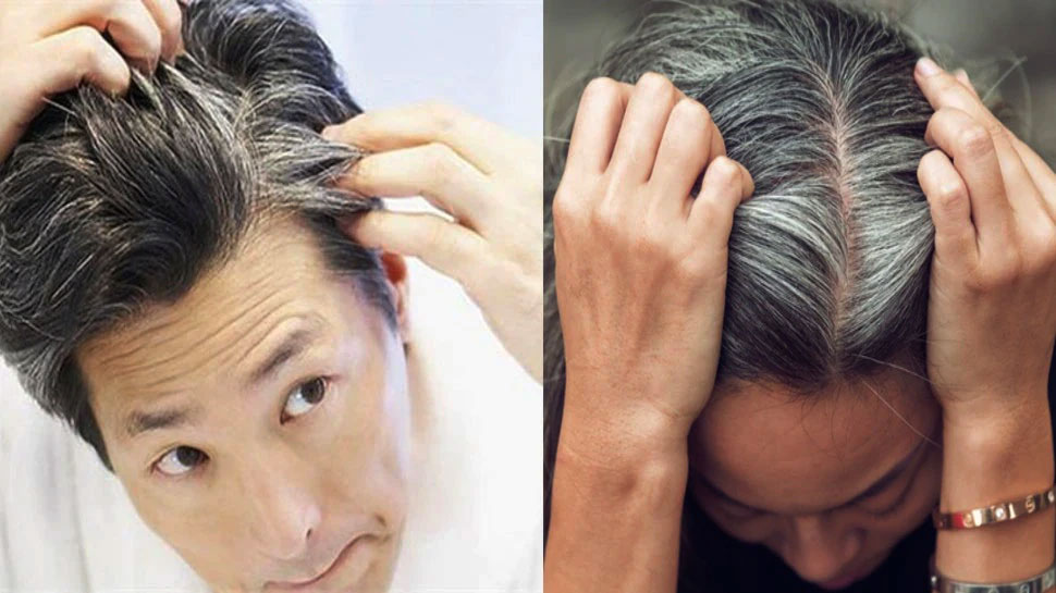 Reason For Premature White Hair at Early Age 25 Years Smoking Drinking Diet  Tension Stress Workout | White Hair Problem: 25 साल की उम्र में बाल होने  लगे सफेद? आज ही छोड़