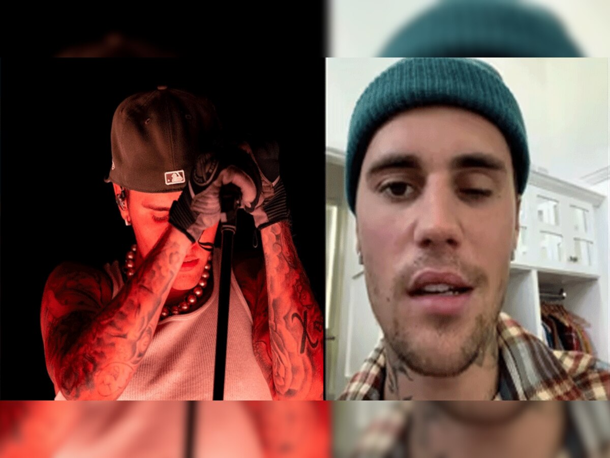 Justin Bieber पैरालिसिस का हुए शिकार, सोशल मीडिया पर बोले- "दुआओं में रखें याद" 