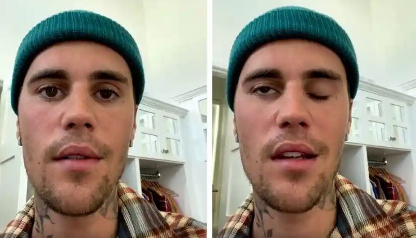 Justin Bieber paralysis: क्या है बीबर को पैरालिसिस करने वाला ये सिंड्रोम? यहां जानिए इस खतरनाक बीमारी के बारे में सबकुछ 