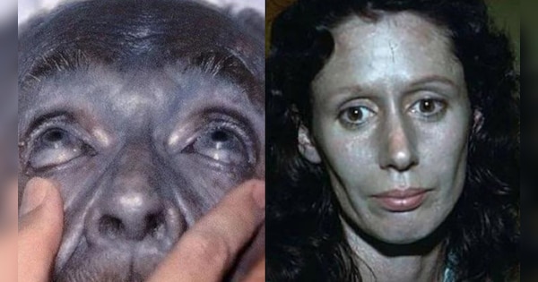 Blue skinned and brown blooded man family skin turns blue incest fugate ...