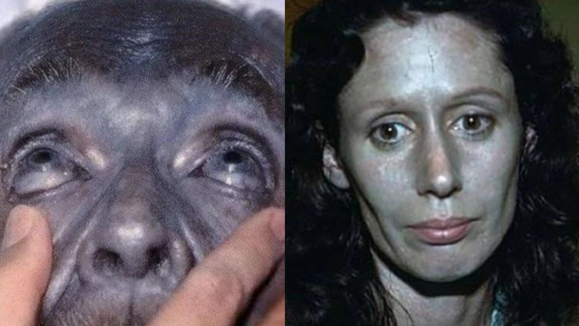 Blue skinned and brown blooded man family skin turns blue incest fugate ...