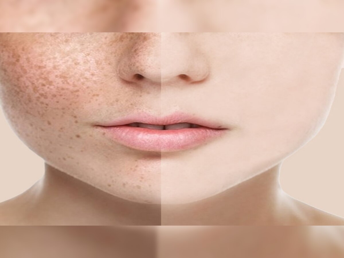 Night Skin Care: सोने से पहले इस तेल से करें मसाज, 30 दिन में बदल जाएगी चेहरे की रौनक