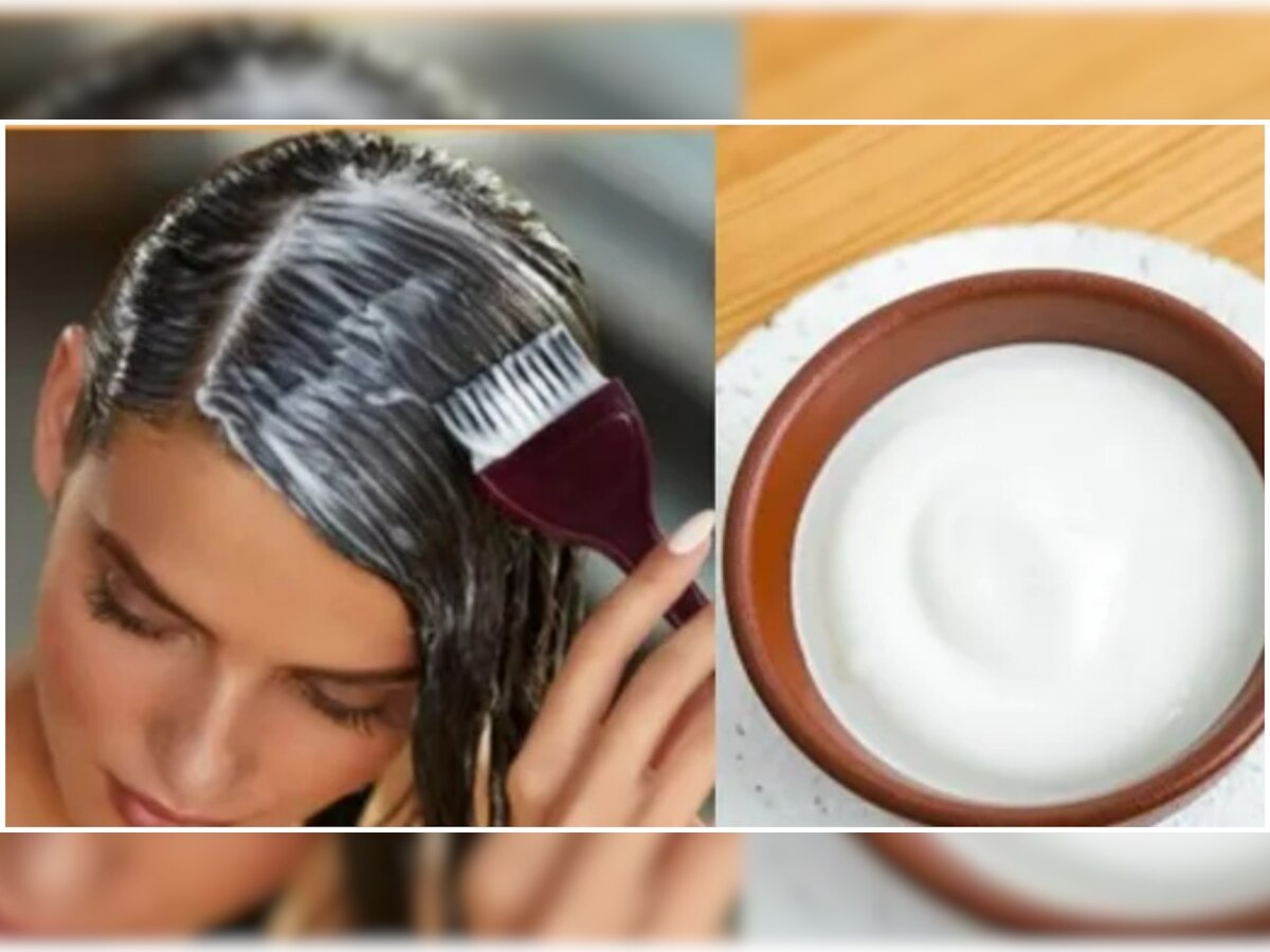 Hair Care Tips: बालों में डैंड्रफ की समस्या से हैं परेशान? तो इस तरह से करें दही और नींबू का इस्तेमाल