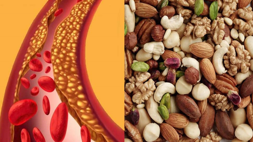 High Cholesterol: इस ड्राई फ्रूट को खाने से नहीं बढ़ता कोलेस्ट्रॉल, आज ही डाइट में करें शामिल