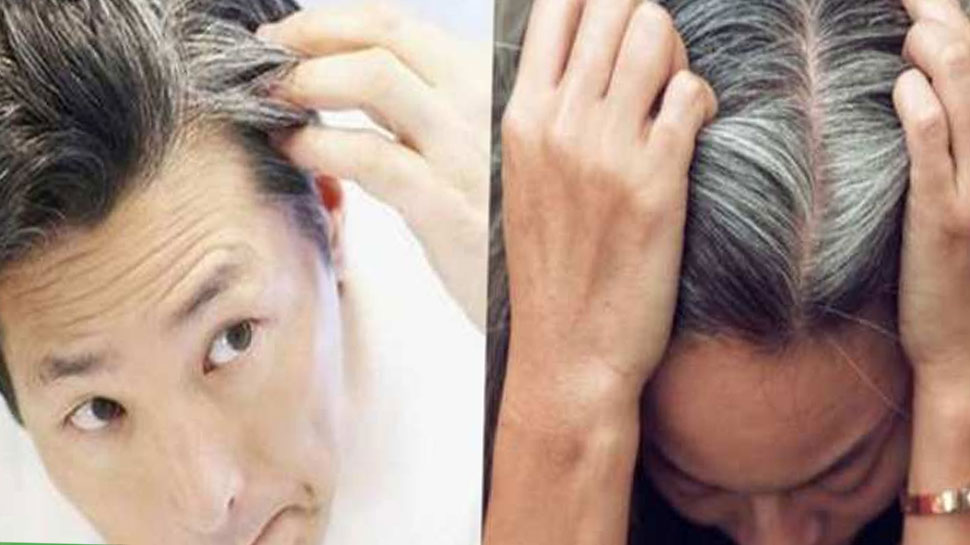 5 Different Ways to Combat Hair Loss And Increase Hair Growth to Hide Male  Pattern Baldness in Hindi  गजपन क छपन क लए परष कर रह ह इन 5  तरक क