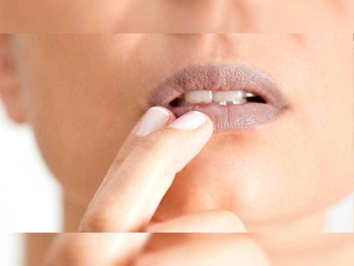 Lips Care Tips: आपकी ये आदत होठों को बना सकती है काला, आज से ही बनाएं दूरी