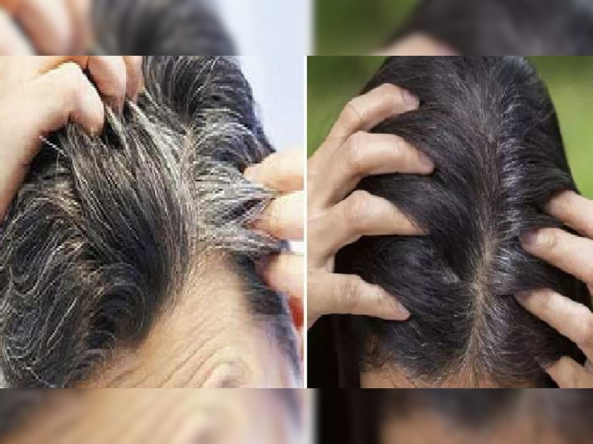 Hair Care Tips: कम उम्र में सफेद बालों से हैं परेशान, तो इन आसान से उपायों से करें इसका निदान