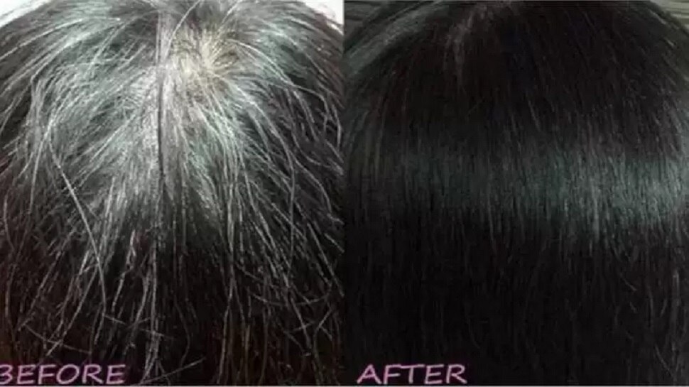 hair-oil-to-treat-white-hair-problem-naturally-know-how-to-make-white