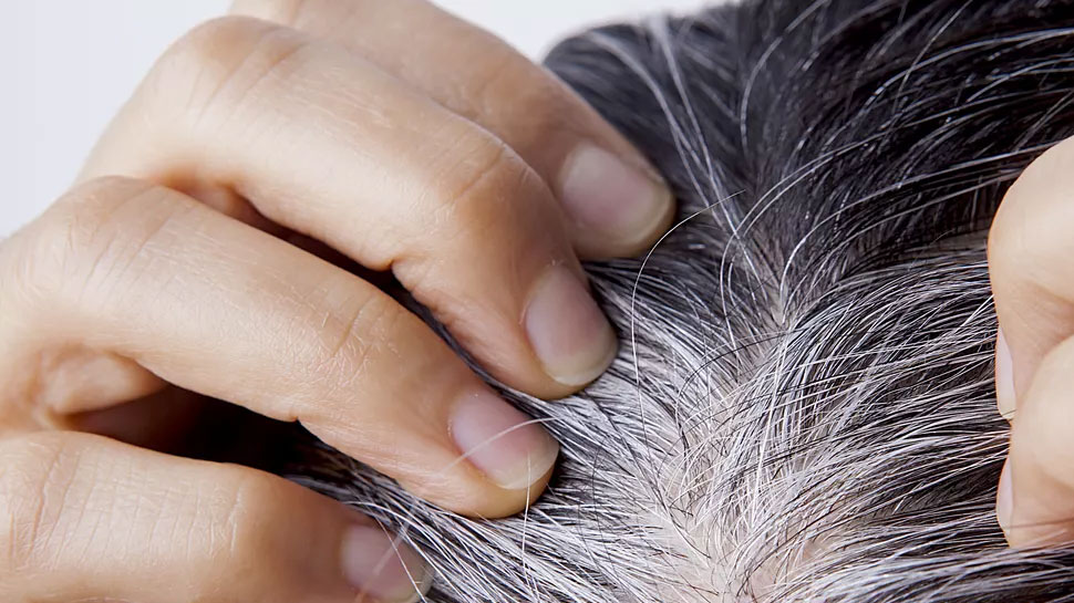 Premature Graying of Hair What Causes White Hair at a Young Age this  deficiency of these vitamins | White Hair Problem: आखिर किस वजह से उम्र से  पहले ही सफेद होने लगते