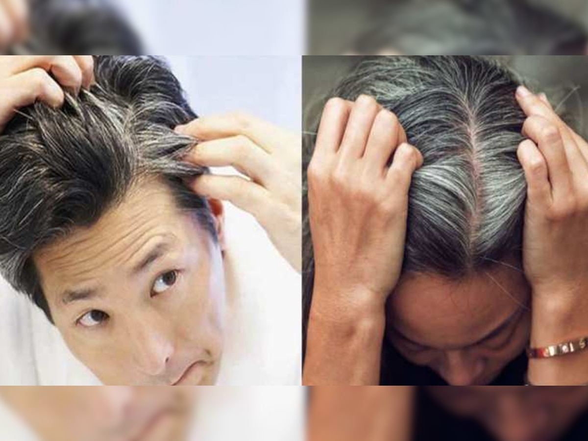 White Hair: इस खास बीज का करें इस्तेमाल, पके हुए बाल फिर हो जाएंगे डार्क