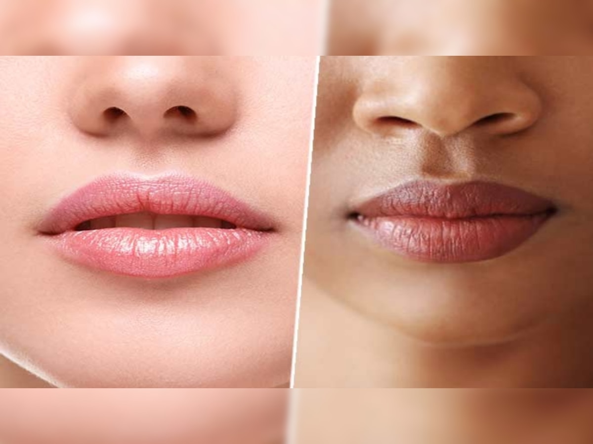 dark lips treatment: होठों का रंग पड़ गया काला तो ट्राई करें ये घरेलू उपाय, समस्या होगी जड़ से खत्म