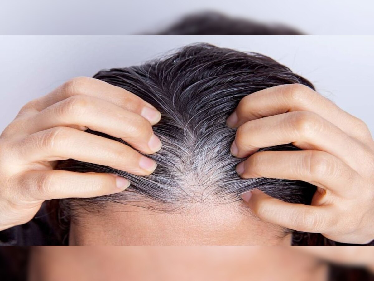 White Hair: समय से पहले सफेद हो रहे हैं बाल? तो ये घरेलू नुस्खा करेगा आपकी मदद