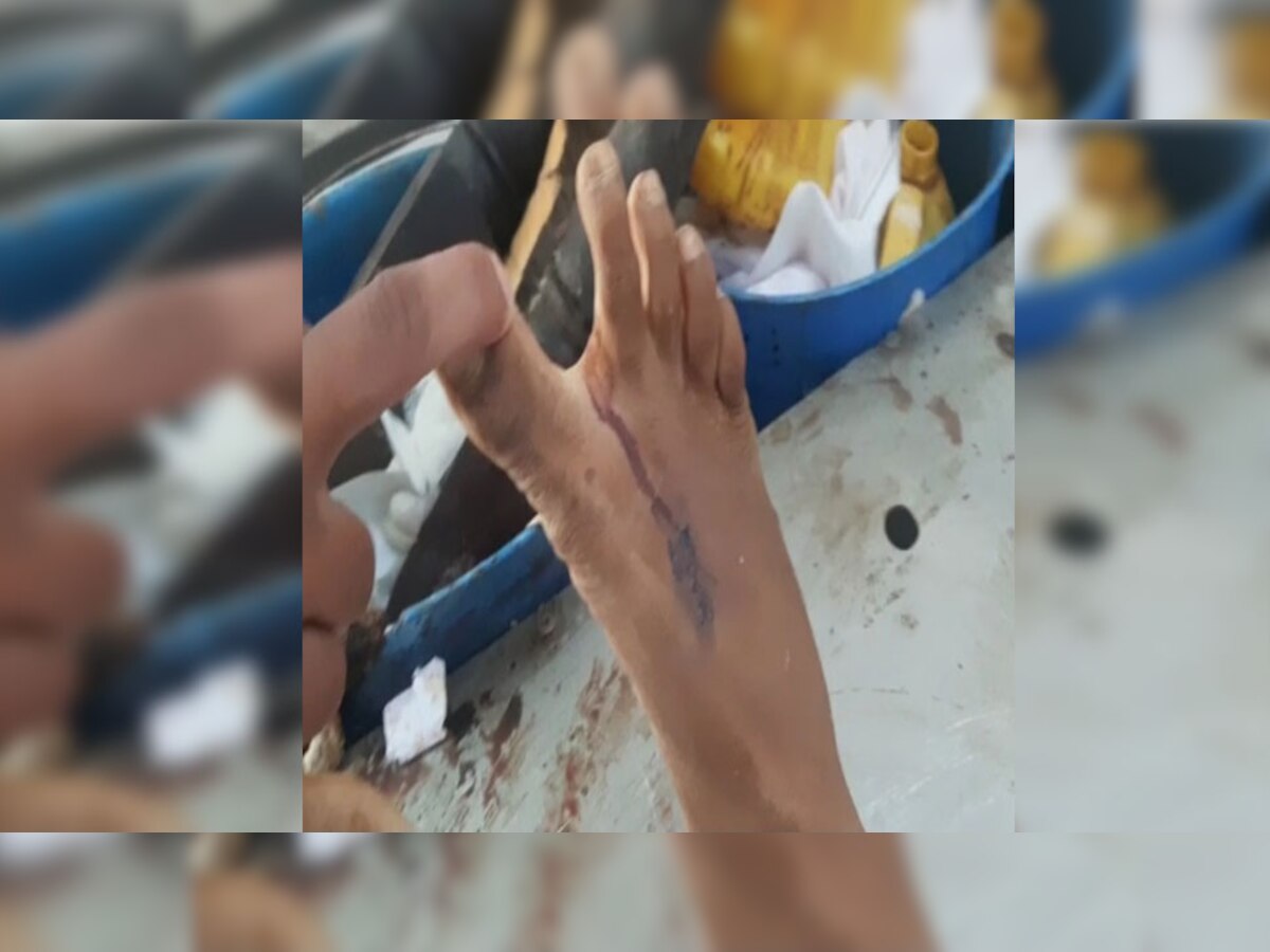 कुशलगढ़ में युवक को सांप से डसा, हुई मौत