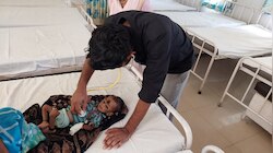 कुपोषण से मौत के बाद प्रशासन में मचा हडकंप, कई बच्चे मौत और जिंदगी की लड़ रहे हैं जंग