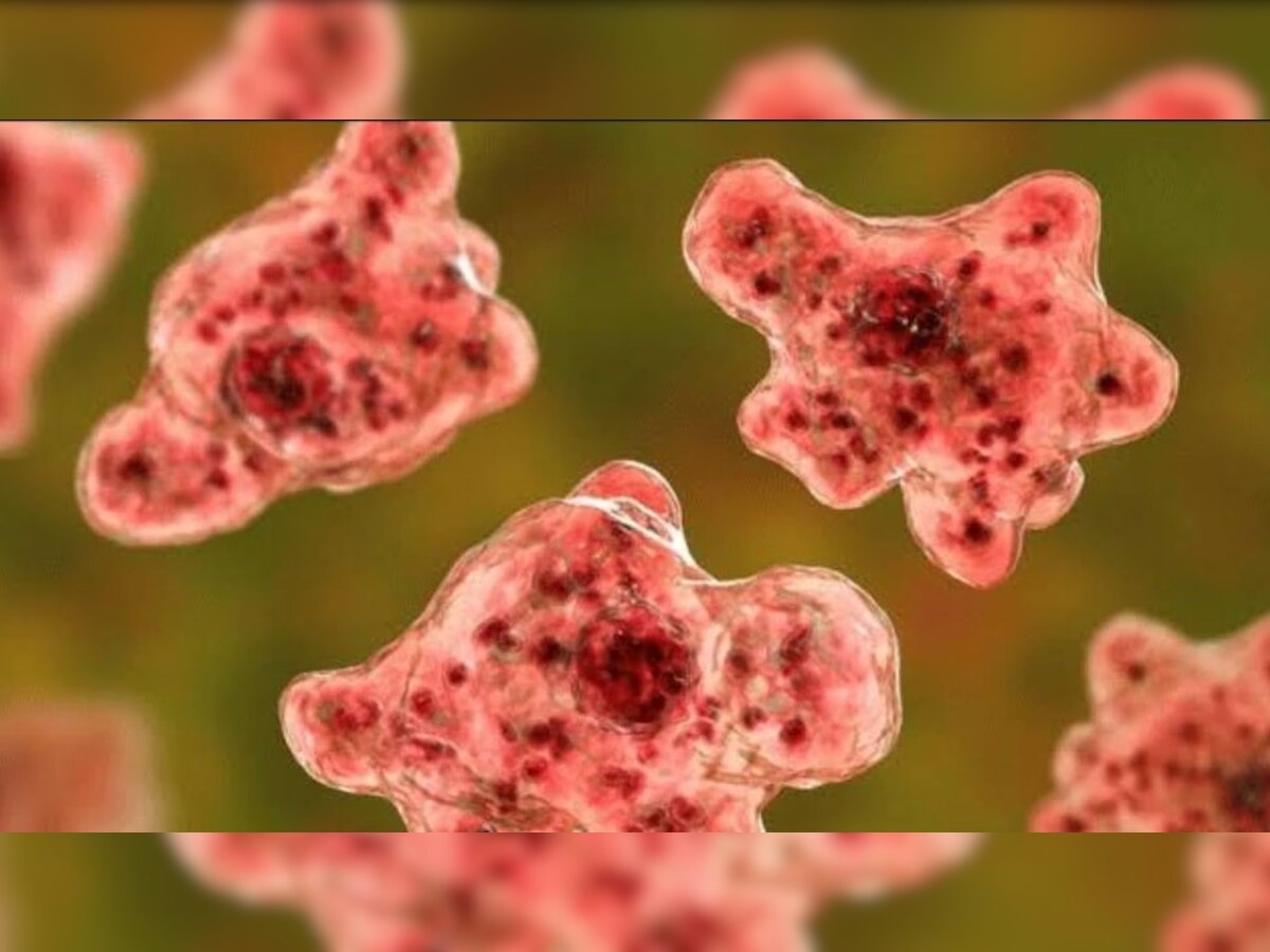 Amoeba Infection: झील में शख्स ने लगाया मौत का गोता! अचानक दिमाग में घुस गया ये 'पैरासाइट'