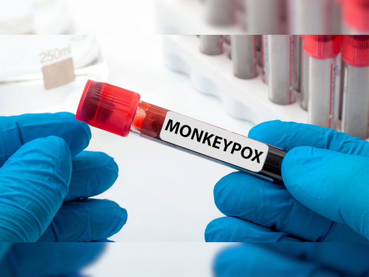 Monkeypox news case in India: मंकीपॉक्स के 2 मामले सामने आने के बाद केंद्र सरकार अलर्ट, जारी हुआ ये आदेश