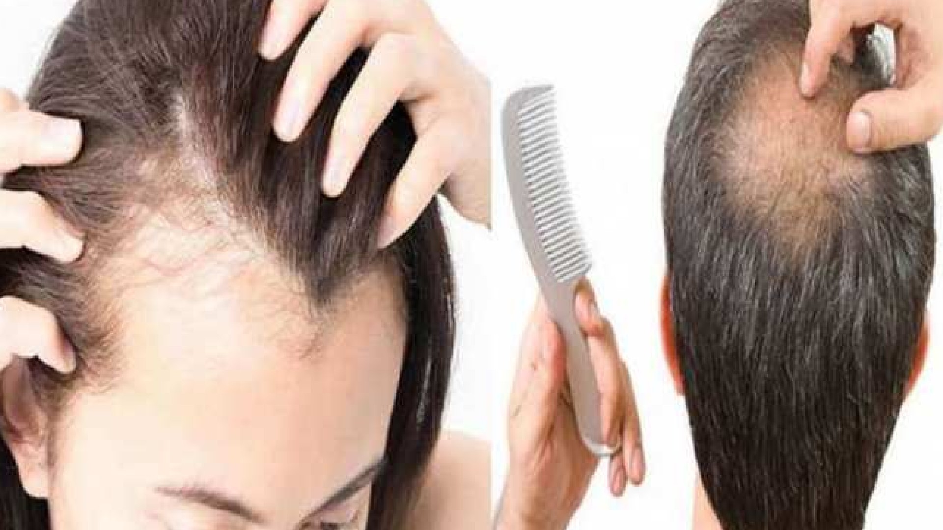 Hair care at home  Berkowits Hair  Skin Clinic