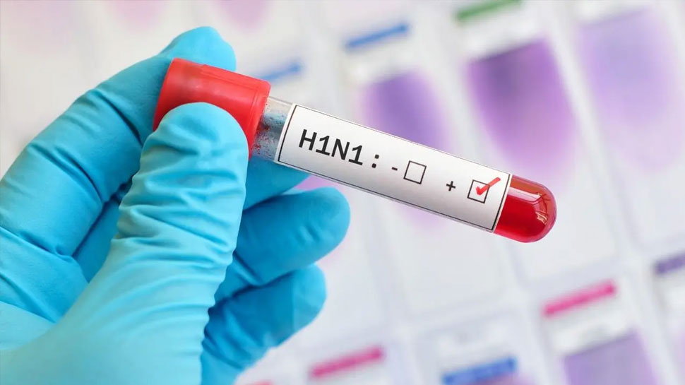 Swine Flu: कोरोना के बाद मडरा रहा है इस खतरनाक संक्रमण का खतरा, इस राज्य में सामने आए केस