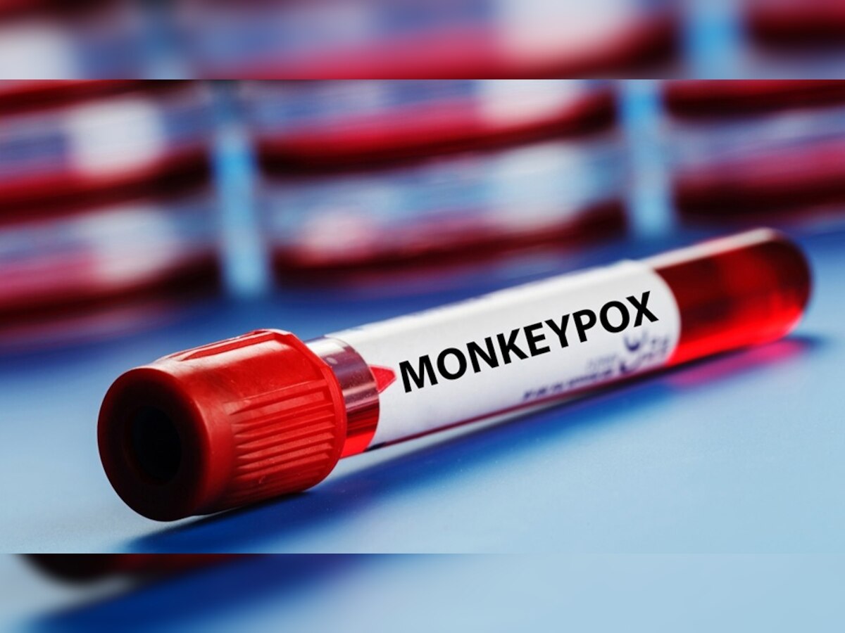 Monkeypox: दुनिया के 60 देशों में फैला मंकीपॉक्स का खतरा, WHO ने अब किया ये बड़ा ऐलान