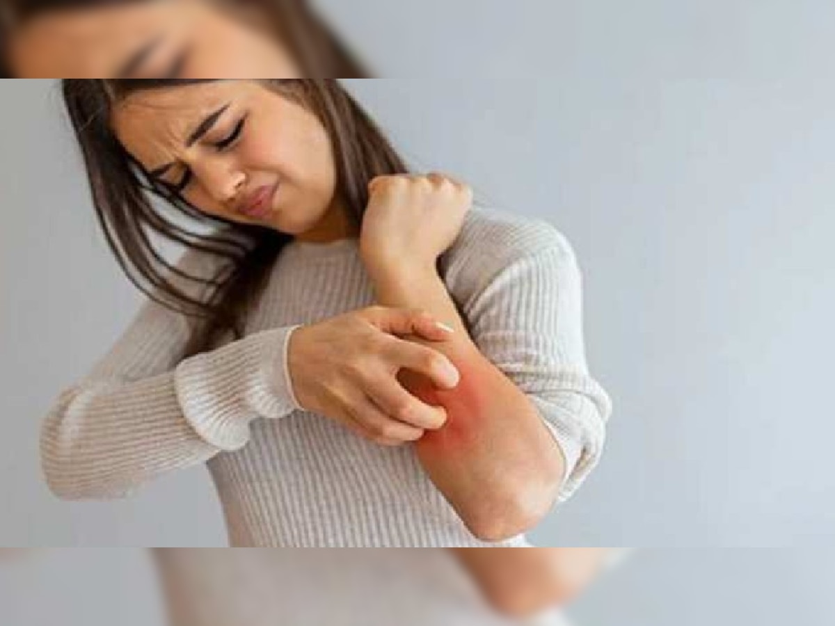 home remedies for getting relief from itching problem immediately apmp
