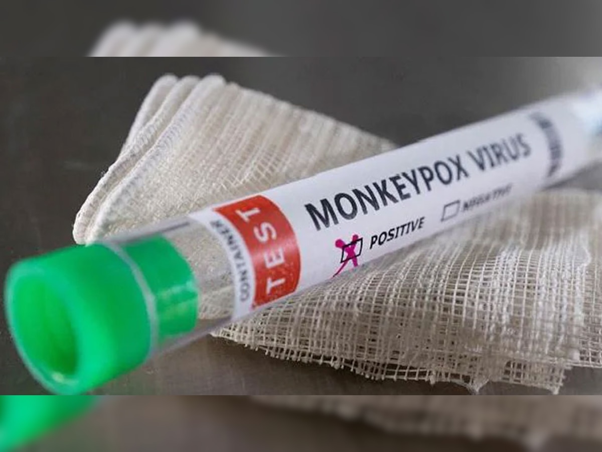 Monkeypox: अब होगी मंकीपॉक्स की जांच, RT-PCR किट हुई लॉन्च; 50 मिनट में मिलेंगे नतीजे