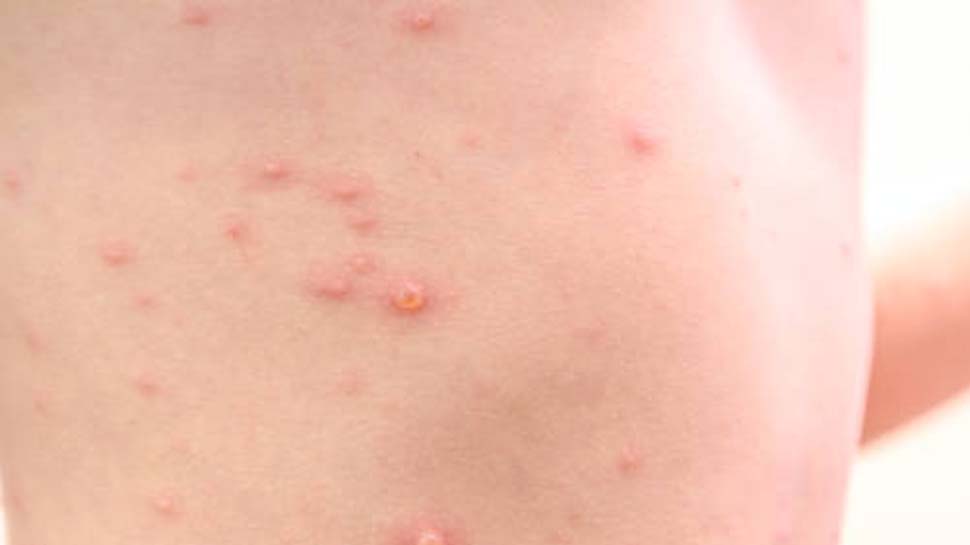 अलामती तस्वीर अलामती तस्वीर