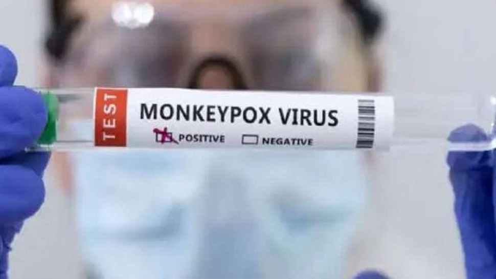 Monkeypox: दिल्ली के बाद नोएडा में भी बढ़ा मंकीपॉक्स का खतरा, सामने आया संदिग्ध केस