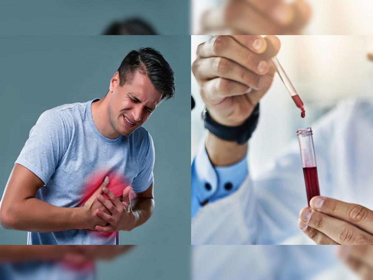 Troponin T Test For Heart Attack Cardiac Arrest Coronary Artery Triple