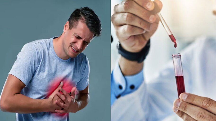Troponin T Test For Heart Attack Cardiac Arrest Coronary Artery Triple ...