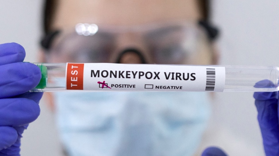 Monkeypox: मंकीपॉक्स के संदिग्ध मरीज की मौत से हड़कंप, केंद्र ने गठित की टास्क फोर्स