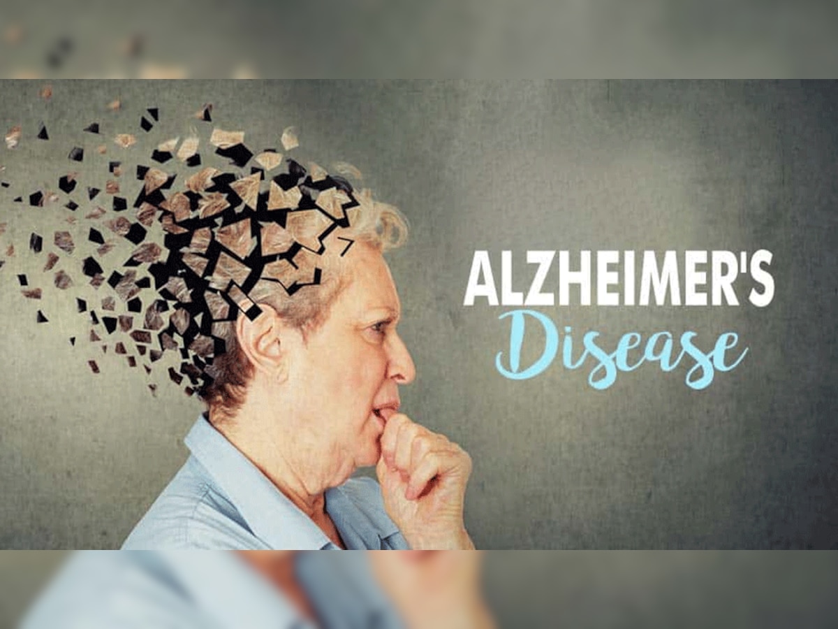  Alzheimer's पर डेढ़ दशक पुरानी Study निकली फर्जी, फेक फोटोज के जरिए हुआ करोड़ों मरीजों की जिंदगी से खिलवाड़