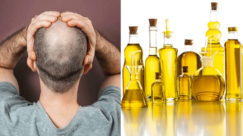 Baldness: Balding tension at an early age, Hair Fall will stop with the help of these 4 oils