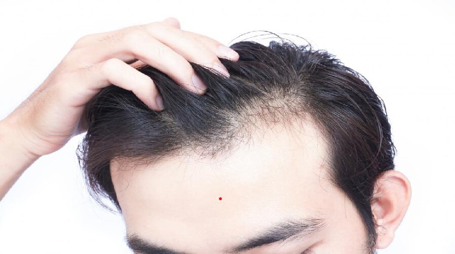 Home Remedy: बालों के झड़ने और टूटने से हैं परेशान, डाइट में तुरंत शामिल करें इन 5 विटामिन्स से भरपूर चीजें
