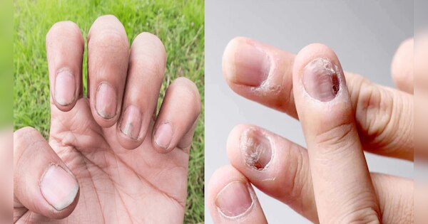 Nails Astrology: अशुभ होते हैं ऐसे नाखून! हमेशा झेलनी पड़ती है पैसों की