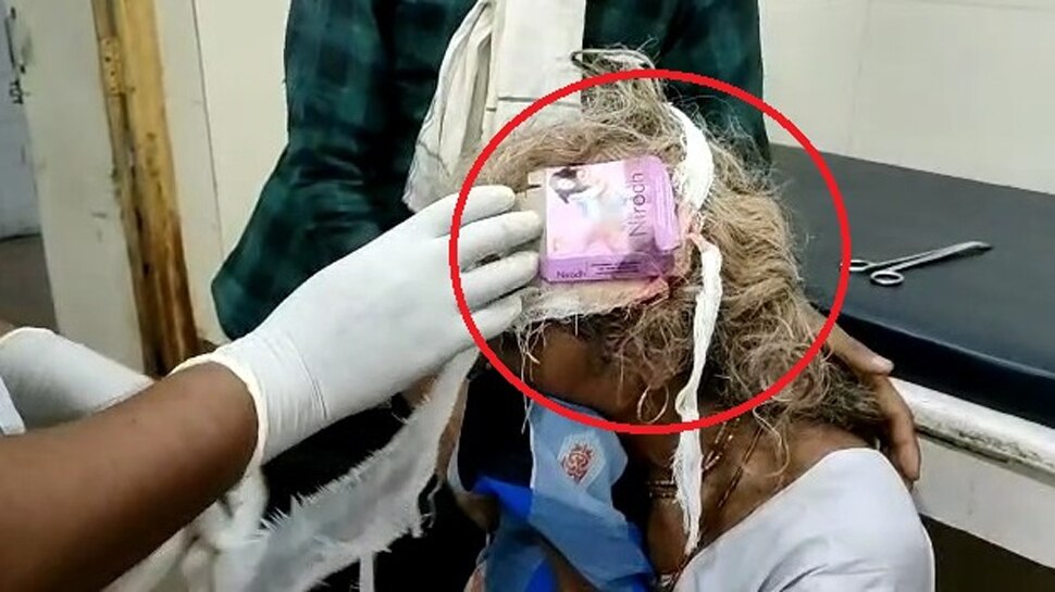 Madhya Pradesh: रुई-पट्टी नहीं… यहां कंडोम का पैकेट लगाकर कर दी घाव की ड्रेसिंग, वायरल हुआ ये VIDEO