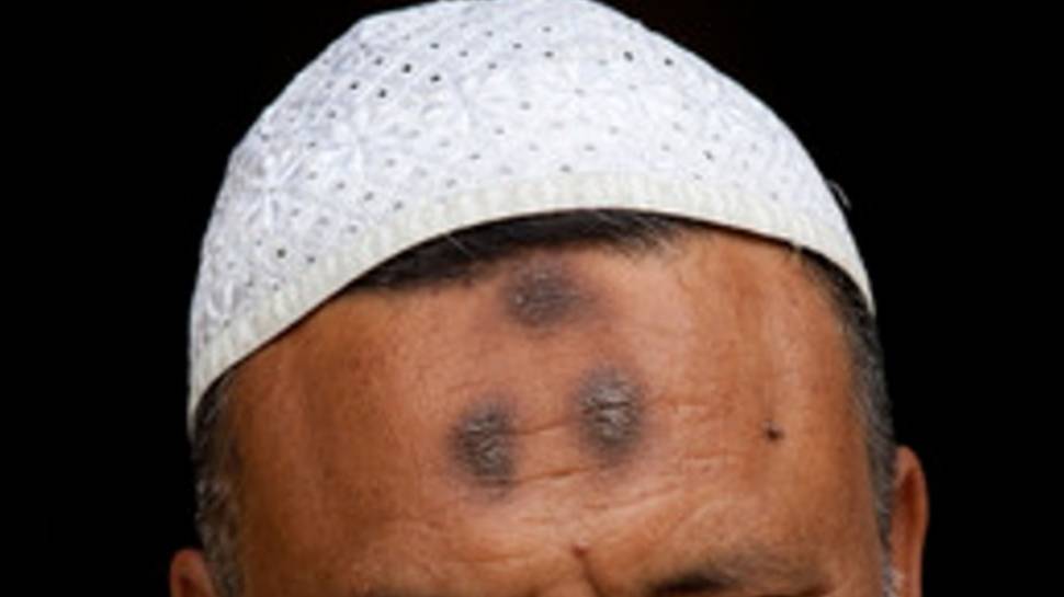Prayer Bump Removal: नमाज़ पढ़ने से माथे पर क्यों आता है निशान, ये काम करने से तुरंत हट जाएगा Prayer Bump Removal: नमाज़ पढ़ने से माथे पर क्यों आता है निशान, ये काम करने से तुरंत हट जाएगा
