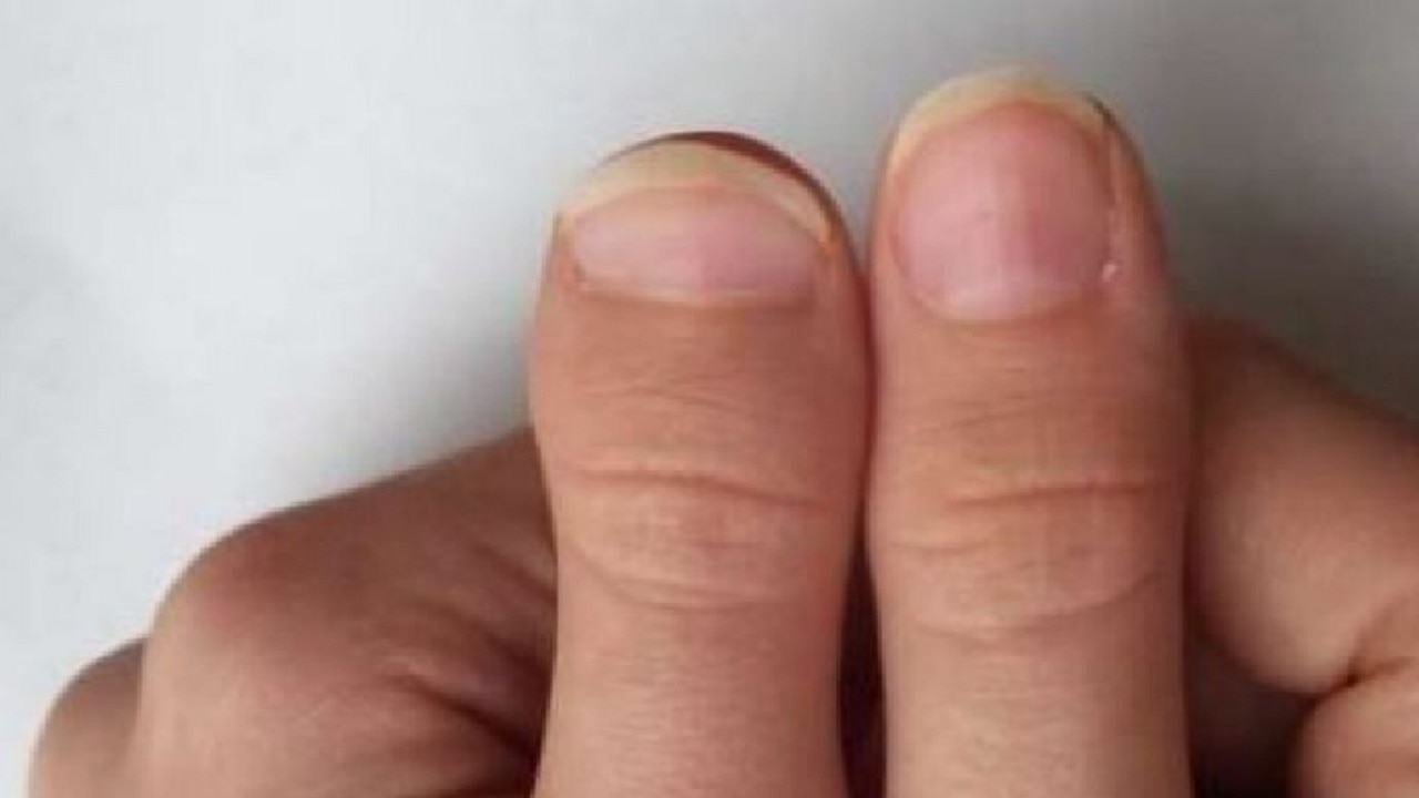 Thumb Palmistry: इस तरह के अंगूठे वाले लोगों को क्यों माना जाता है खास? जानें क्या कहता है आपका अंगूठा